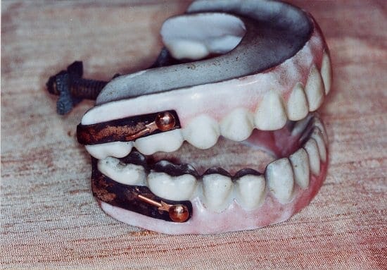 5. Prothésiste dentaire et denturologie : une complémentarité au service de la santé 7 innovation dentaire XIX siècle